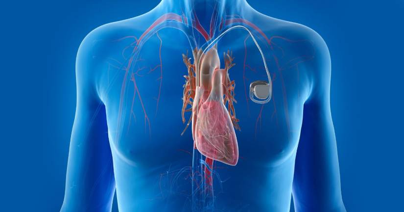euro-swiss-y-la-dinamica-comercial-de-los-dmi-dispositivos-medicos-implantables