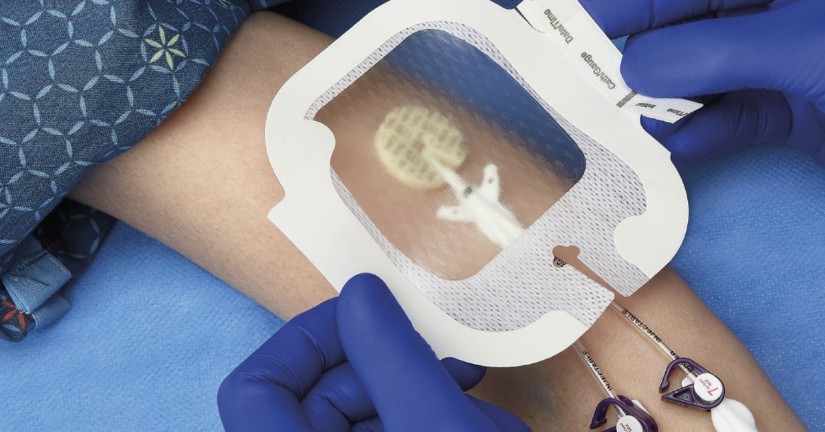 apositos-medline-proteccion-comodidad-y-tecnologia-para-el-cuidado-del-paciente