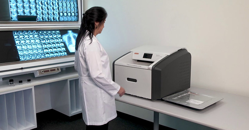 DryView 5700 de Carestream. Impresión láser de películas para diagnóstico médico de máxima fidelidad