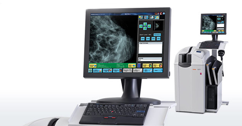 que-es-un-cateter-de-embolectomia