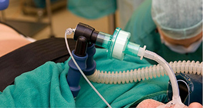 Características de la Aspiración Traqueal