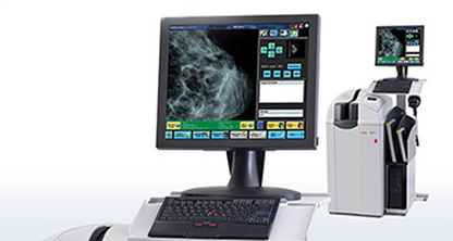 Chasis de mamografía de CARESTREAM