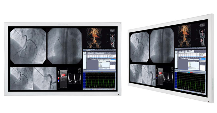 conozca-el-monitor-de-alta-definicion-de-55-para-cirugia-s551