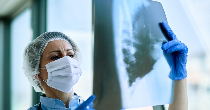 dia-mundial-de-la-tuberculosis-2023